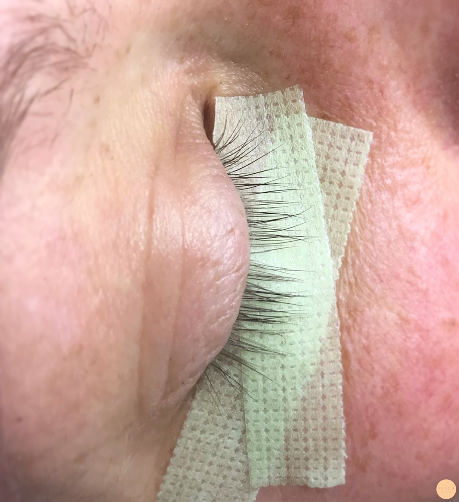 Fransförlängning trots tappat fransar