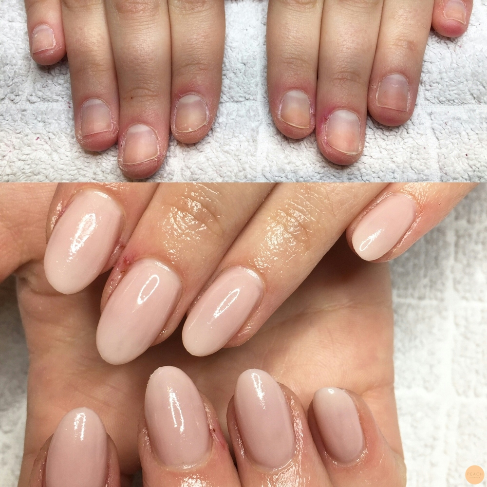 Nagelförlängning på nagelbitare