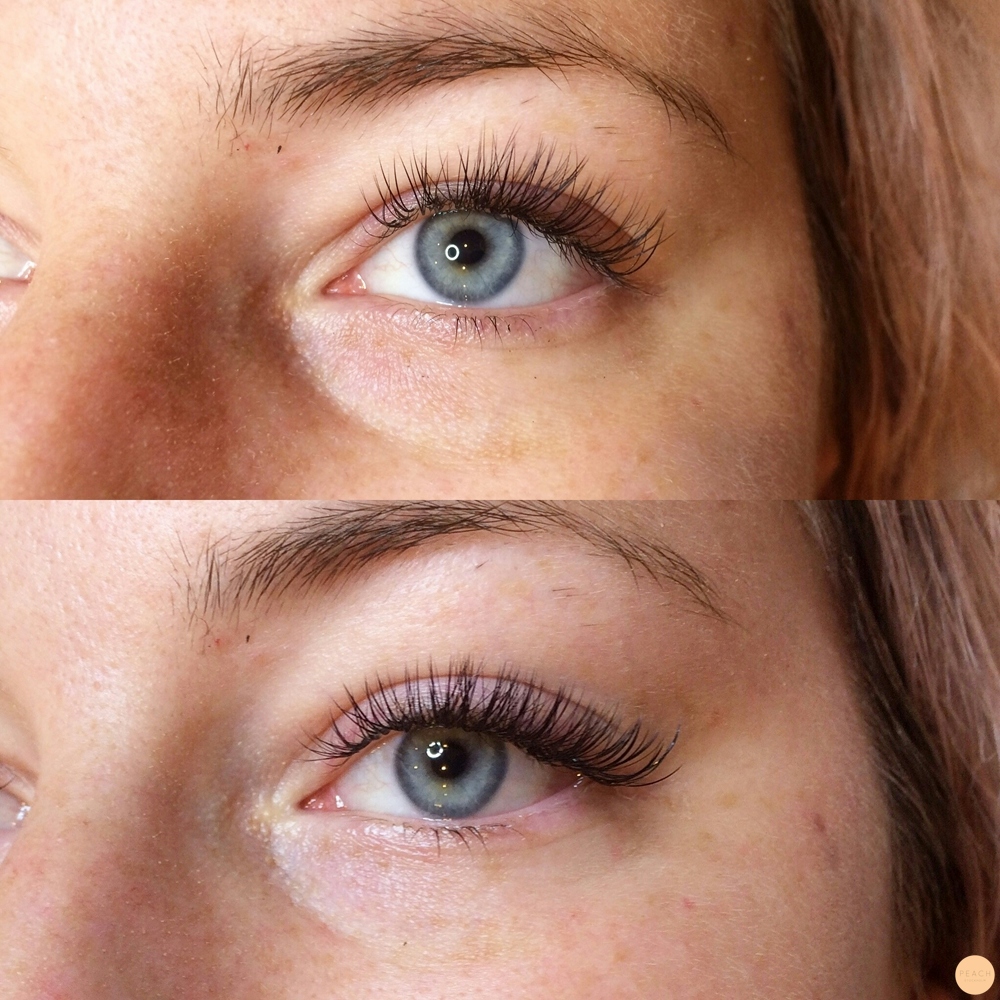 Före/efter 4 veckors volympåfyll