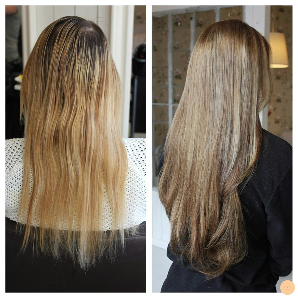 Extensions