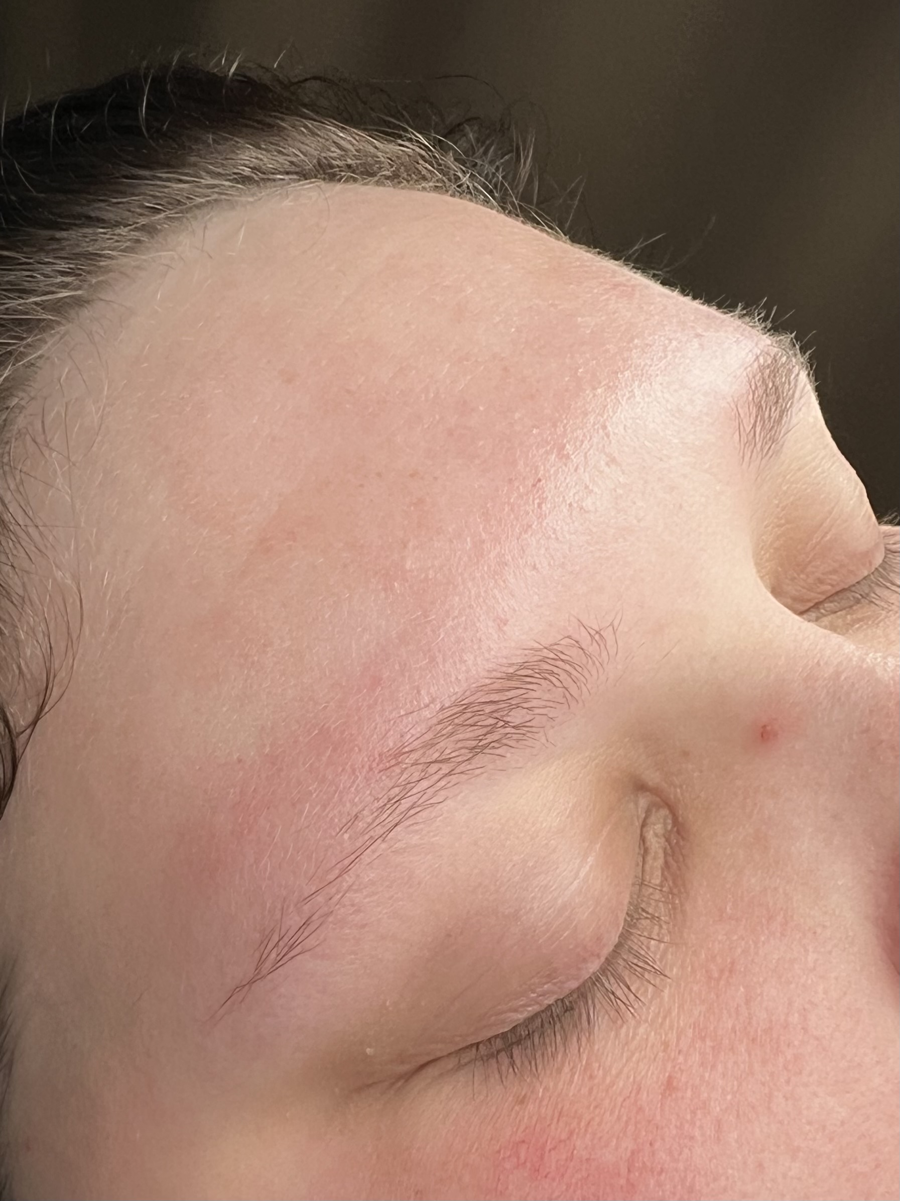 ✨ Browlift före & efter ✨