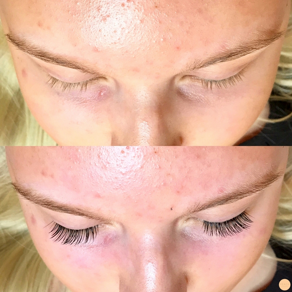 Nytt sett singelfransar