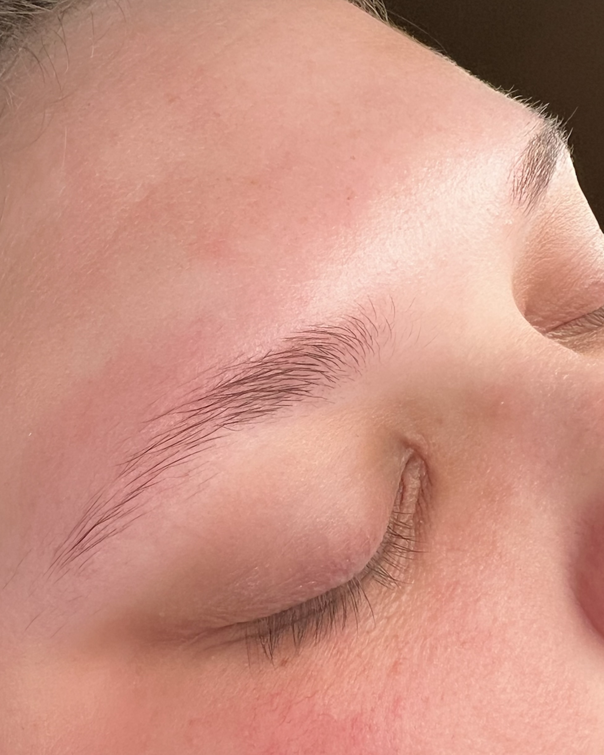 Browlift och brynformning